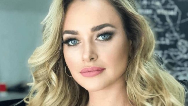 Daniela Nicolás reveló particular problema médico: se fracturó por un abrazo