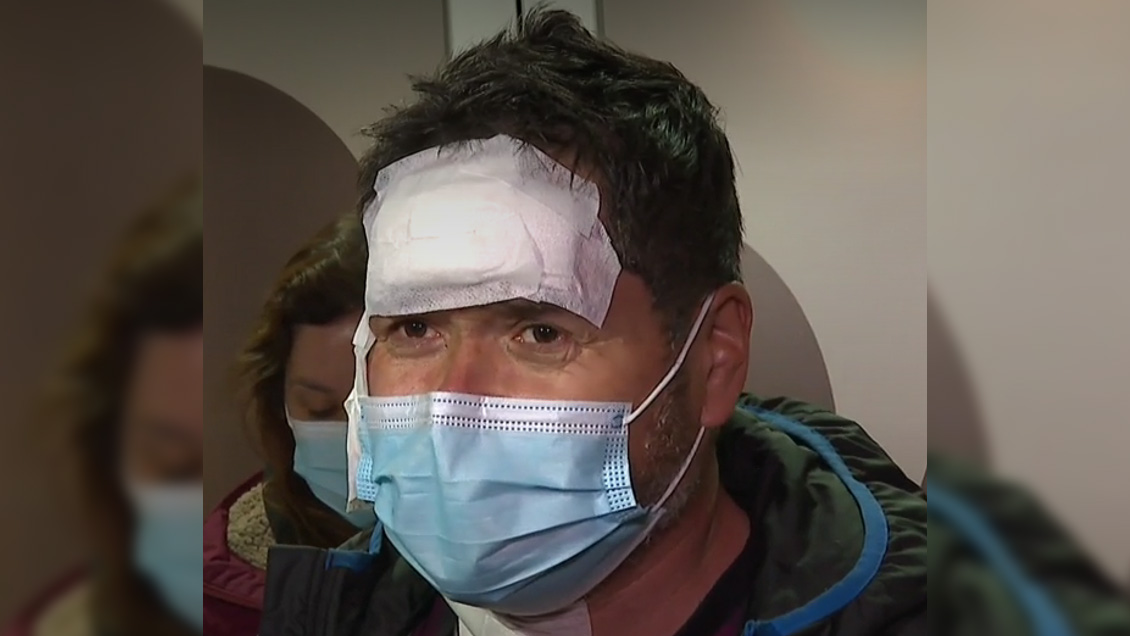 Paramédico agredido en Traiguén: 