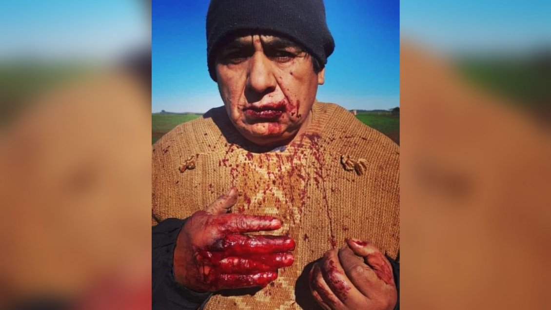 Incidentes en Galvarino: Un lonko y dos carabineros heridos