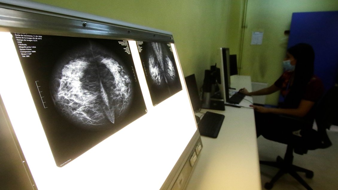 Minsal confirmó atraso en meta fijada de exámenes para pesquisar cáncer