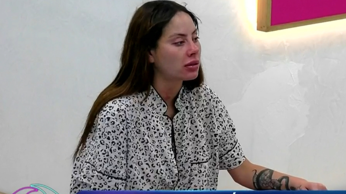 Ignacia Michelson sufrió una crisis alérgica en "Gran Hermano Ignacia Michelson sufrió una crisis alérgica en "Gran Hermano