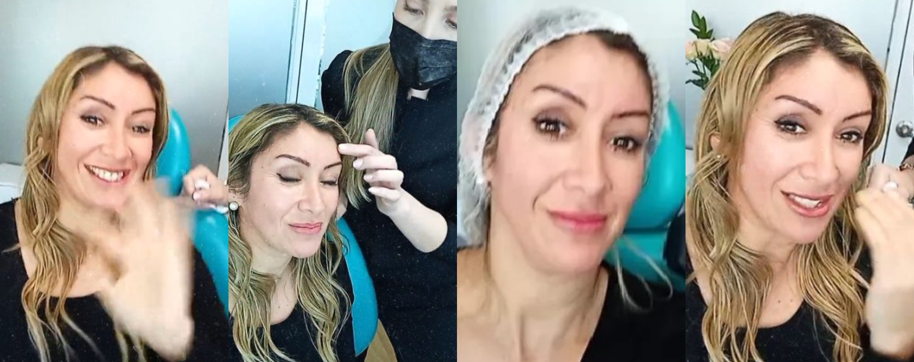 Angélica Sepúlveda se inyectó bótox antes de su ingreso a "Tierra Brava Angélica Sepúlveda se inyectó bótox antes de su ingreso a "Tierra Brava