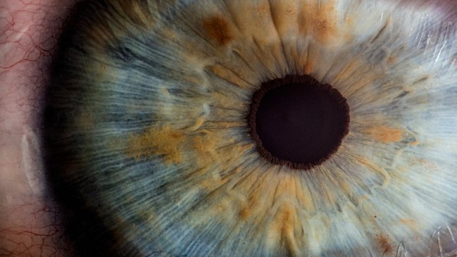 Científicos lograron detectar el párkinson analizando las moléculas del ojo  