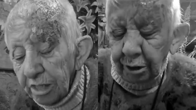 Adulta mayor denuncia que fue atacada con ácido y mataron a sus perros en La Florida