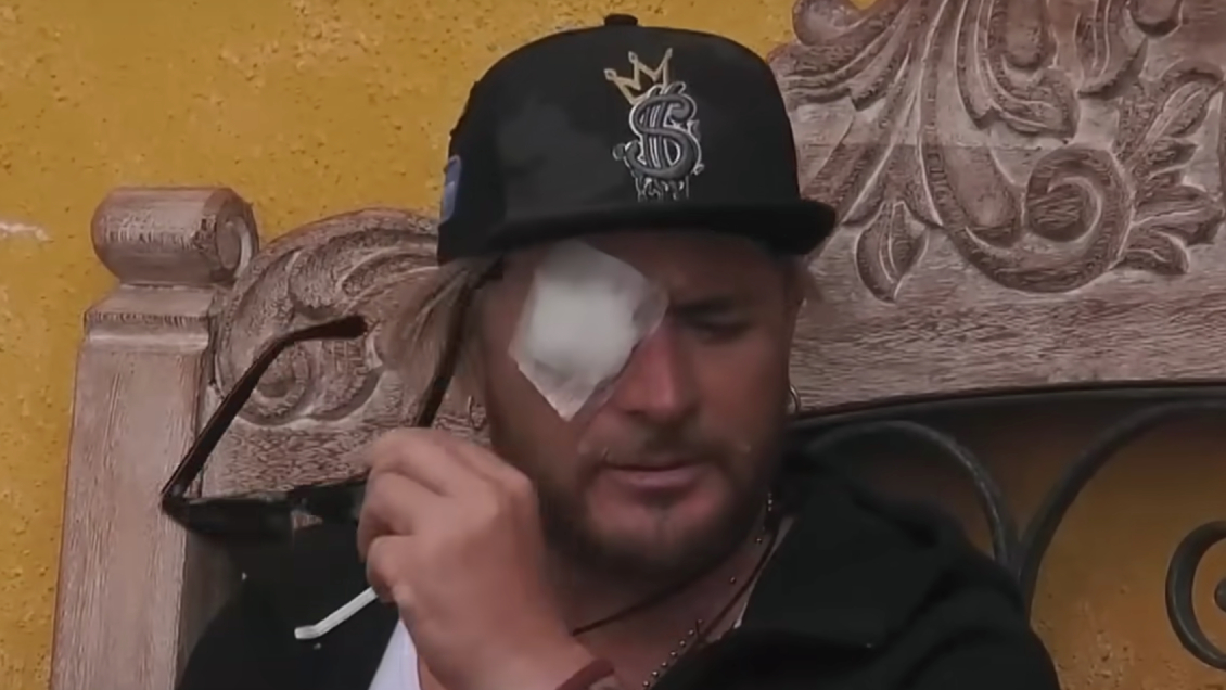 Junior Playboy sufrió infección en 