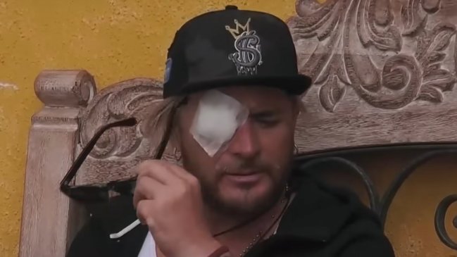 Junior Playboy sufrió infección en 