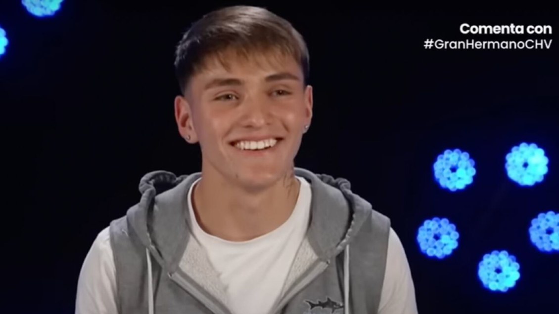 Hans se hizo retoque estético tras salir de 