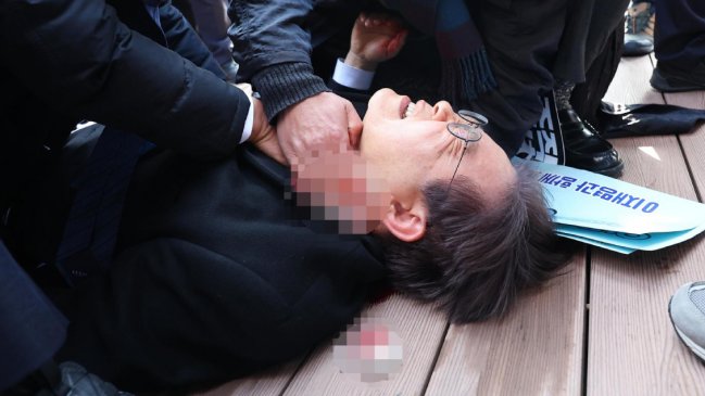  Líder de la oposición de Corea del Sur fue apuñalado en el cuello  