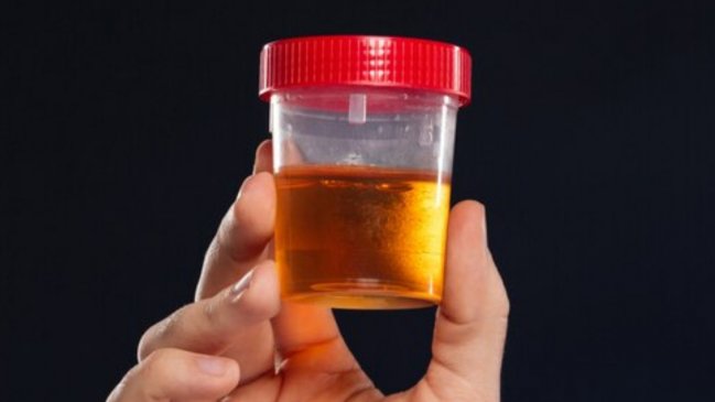 Fin a siglos de misterio: Investigadores descubrieron por qué la orina es amarilla