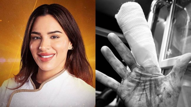 Gianella Marengo tuvo grave accidente en grabación de Top Chef VIP Chile