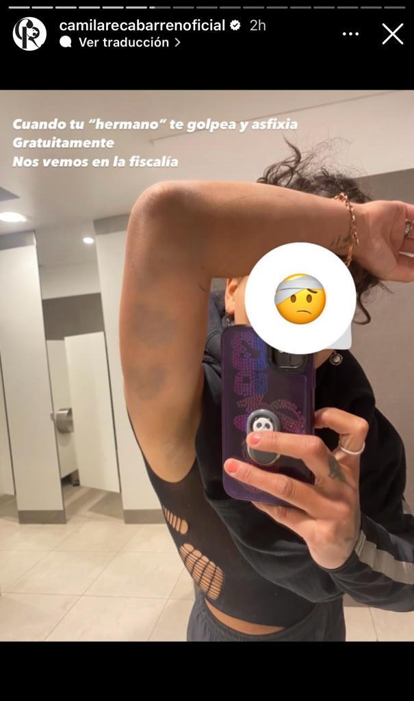 Camila Recabarren denunció a su hermano por golpearla y asfixiarla Camila Recabarren denunció a su hermano por golpearla y asfixiarla