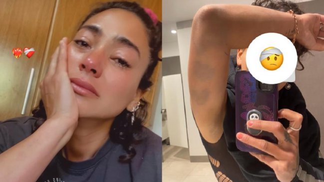 Camila Recabarren denunció brutal agresión por parte de su hermano