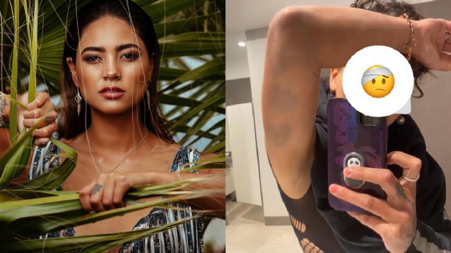 Camila Recabarren detalló agresión de su hermano: 