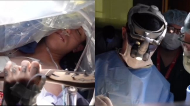 Impresionante: Hombre tocó la guitarra mientras le extirpaban un tumor de su cerebro