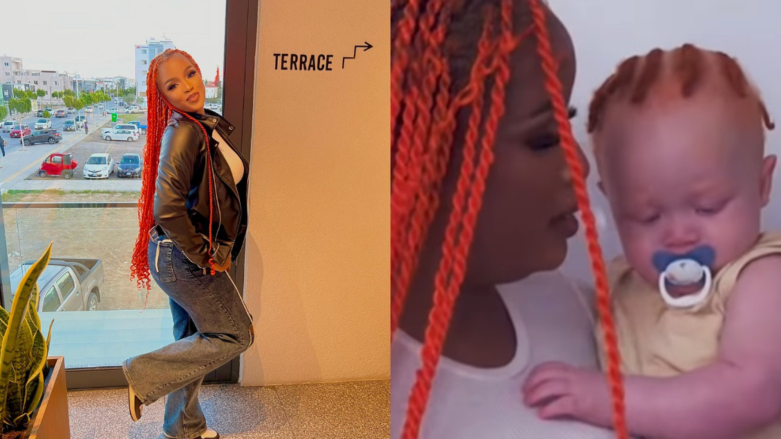 Mamá negra dio a luz a bebé albino y pelirrojo Mamá negra dio a luz a bebé albino y pelirrojo