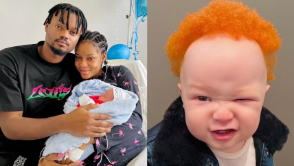 Mujer negra dio a luz a un bebé albino y pelirrojo