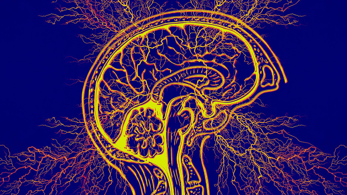 Guatemala en alerta por incremento de casos de una enfermedad neurológica aguda