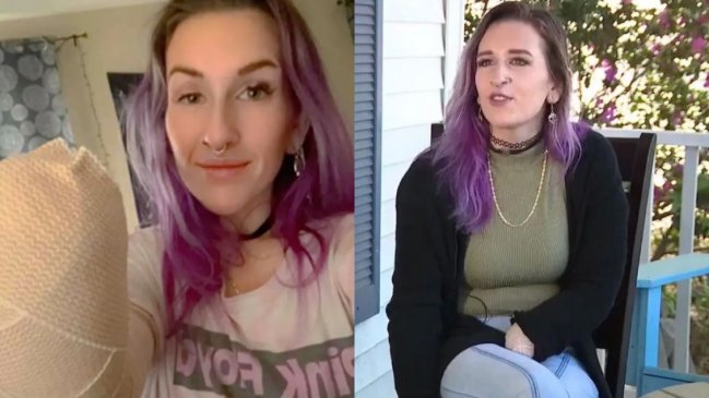 Mujer perdió su mano debido a insólito accidente con su secador de pelo