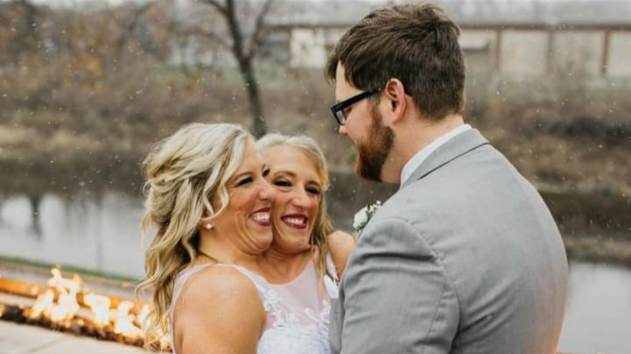 Abby y Brittany hermanas gemelas siamesas