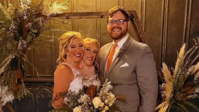 Una de las famosas siamesas de 