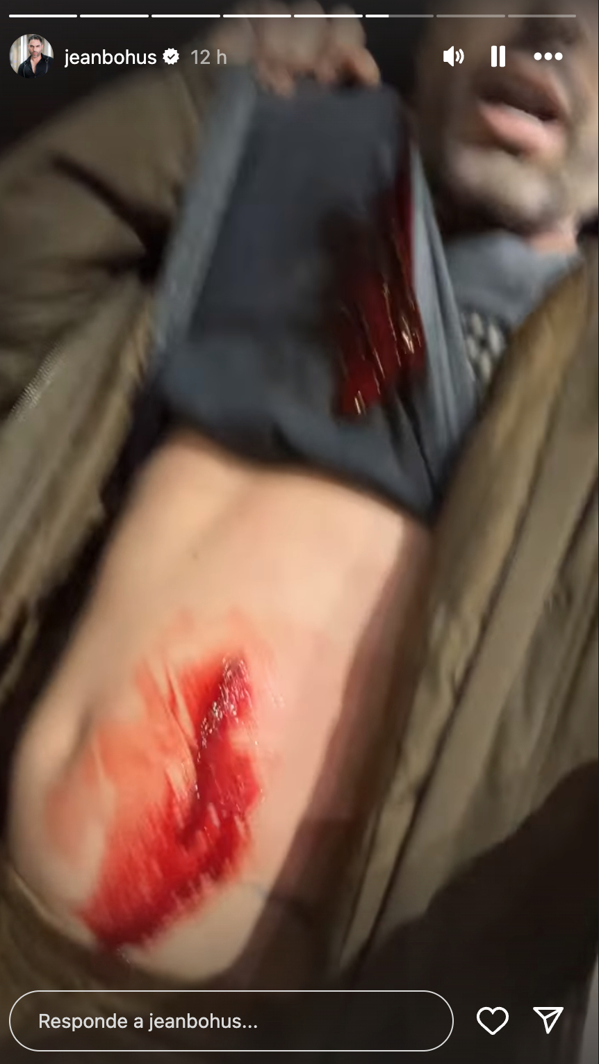 Asalto a Jean Bohus Jean Bohus fue asaltado