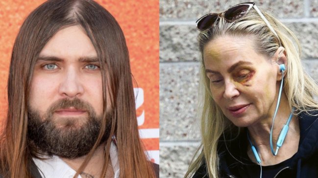 Hijo de Nicolas Cage es acusado de golpear brutalmente a su madre