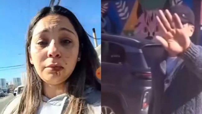 Hombre dio puñetazo en el rostro a mujer tras accidente de tránsito en Concón