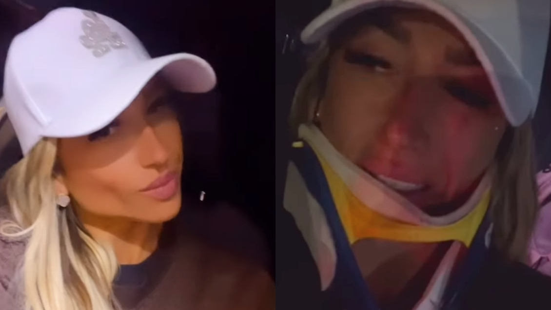 Nicole Moreno sufrió accidente en auto: Publicó todo en redes sociales