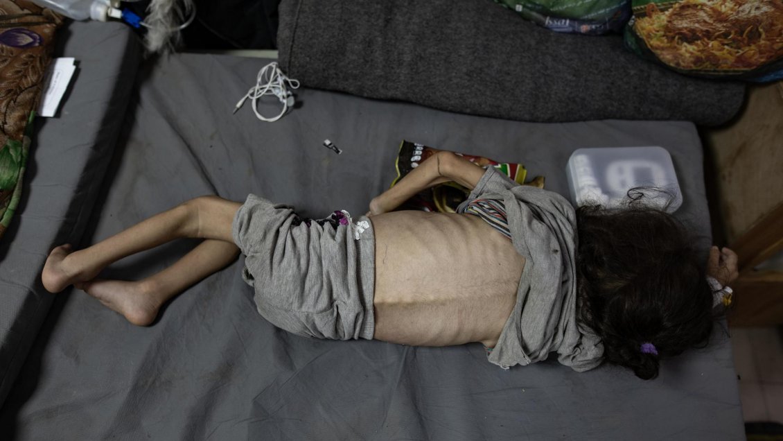 Toda la población de Gaza está al borde del colapso, denuncia Acción contra el Hambre