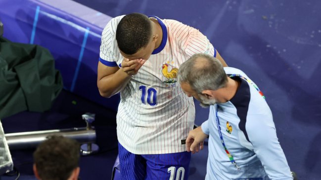 Mbappé se sometió a exámenes y no será operado por lesión en la nariz