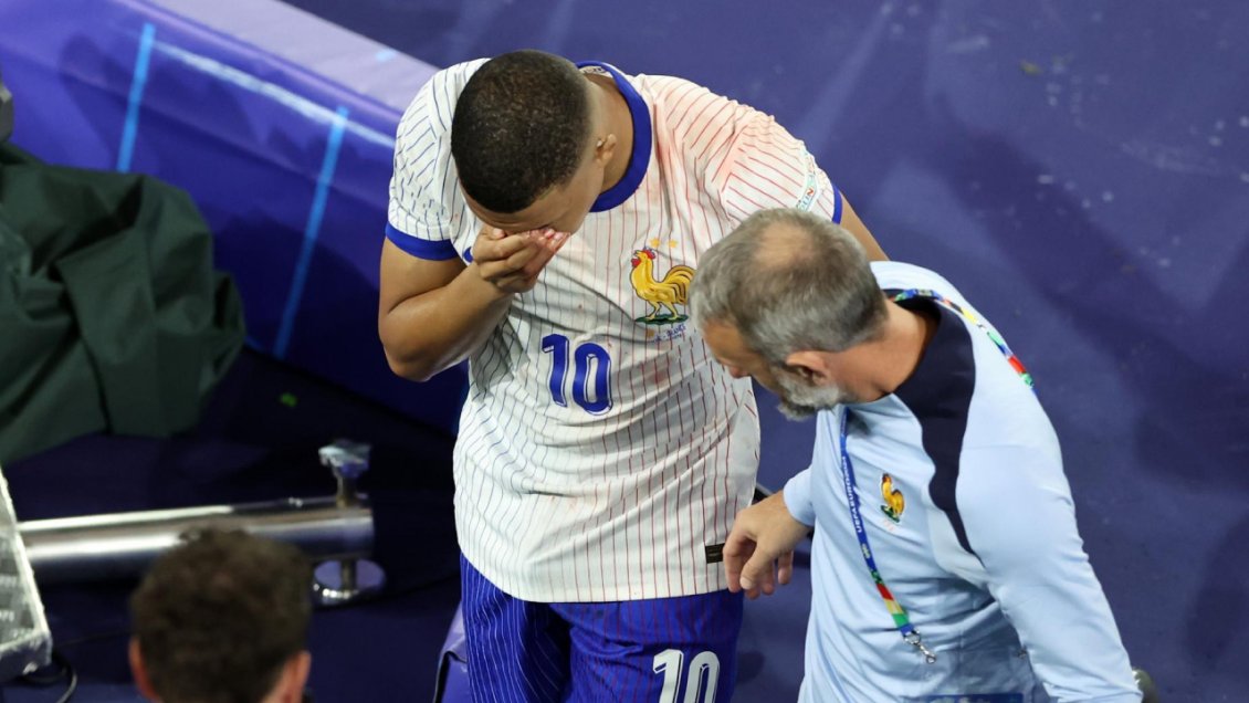 Mbappé se sometió a exámenes y no será operado por lesión en la nariz