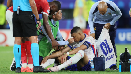   La fractura de Kylian Mbappé ante Austria en el debut por la Eurocopa 2024 