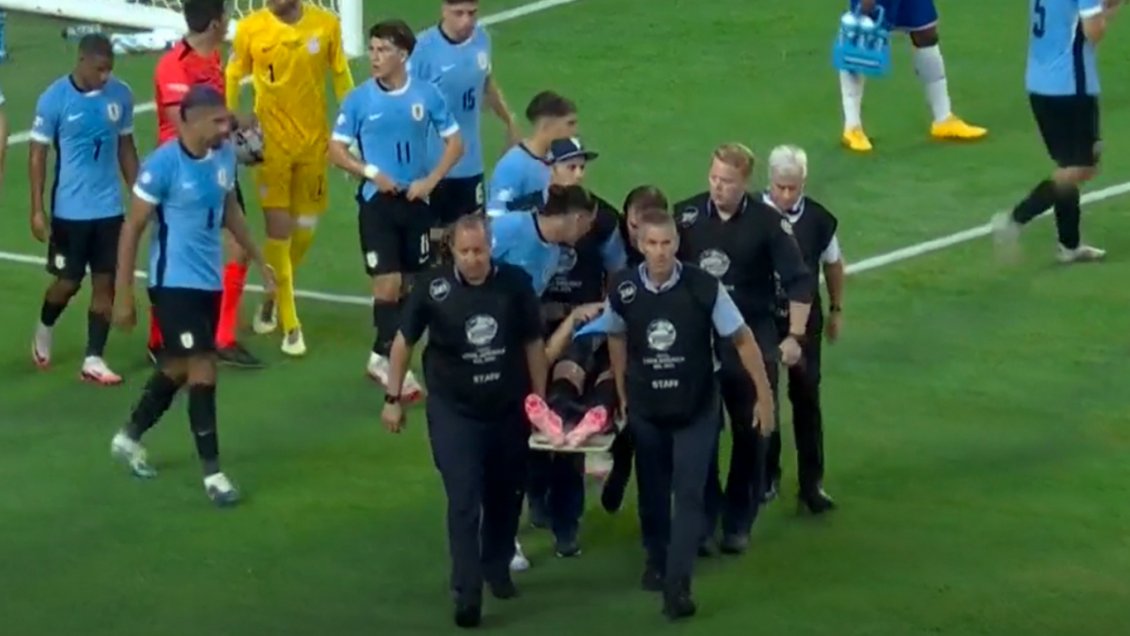 [VIDEO] Preocupación en Uruguay: Maxi Araújo sufrió duro choque y salió en camilla