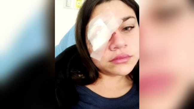 Joven madre perdió visión al recibir pedrada en una micro durante el 