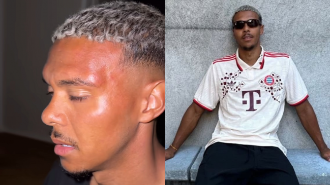 Barristas de Nuremberg golpearon a un jugador por usar camiseta de Bayern Múnich