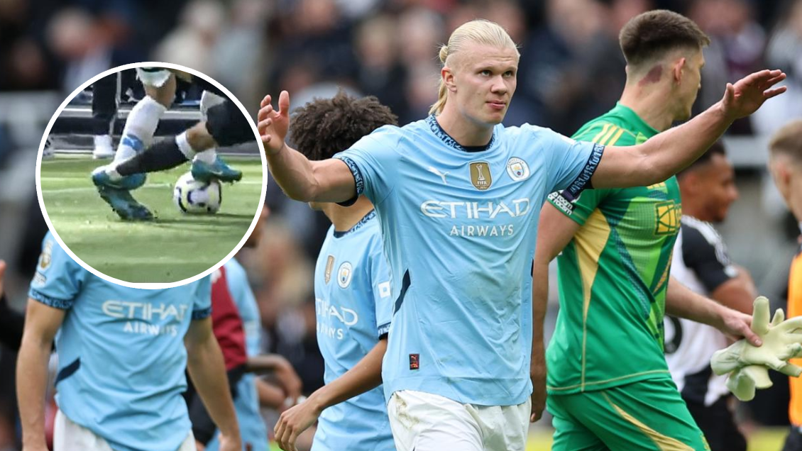 Dura postal: Así quedó el pie de Haaland por patada que recibió ante Newcastle