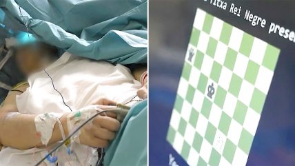   Hombre jugó ajedrez mientras le extirpaban un tumor cerebral 