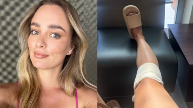 Kika Silva sufrió molestoso accidente doméstico: Salió de clínica en silla de ruedas