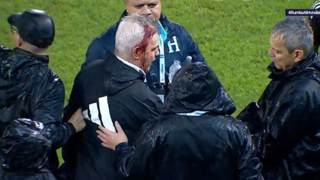 DT de México sufrió grave agresión de hincha y terminó sangrando tras caída ante Honduras