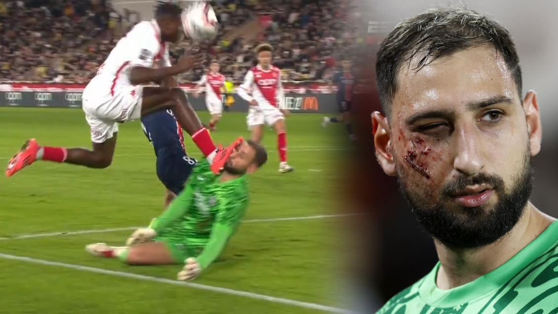 [VIDEO] Donnarumma recibió un durísimo planchazo en la cara ante Mónaco