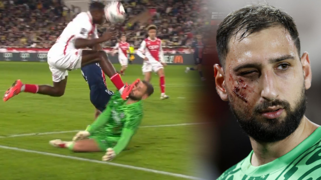 [VIDEO] Donnarumma recibió un durísimo planchazo en la cara ante Mónaco