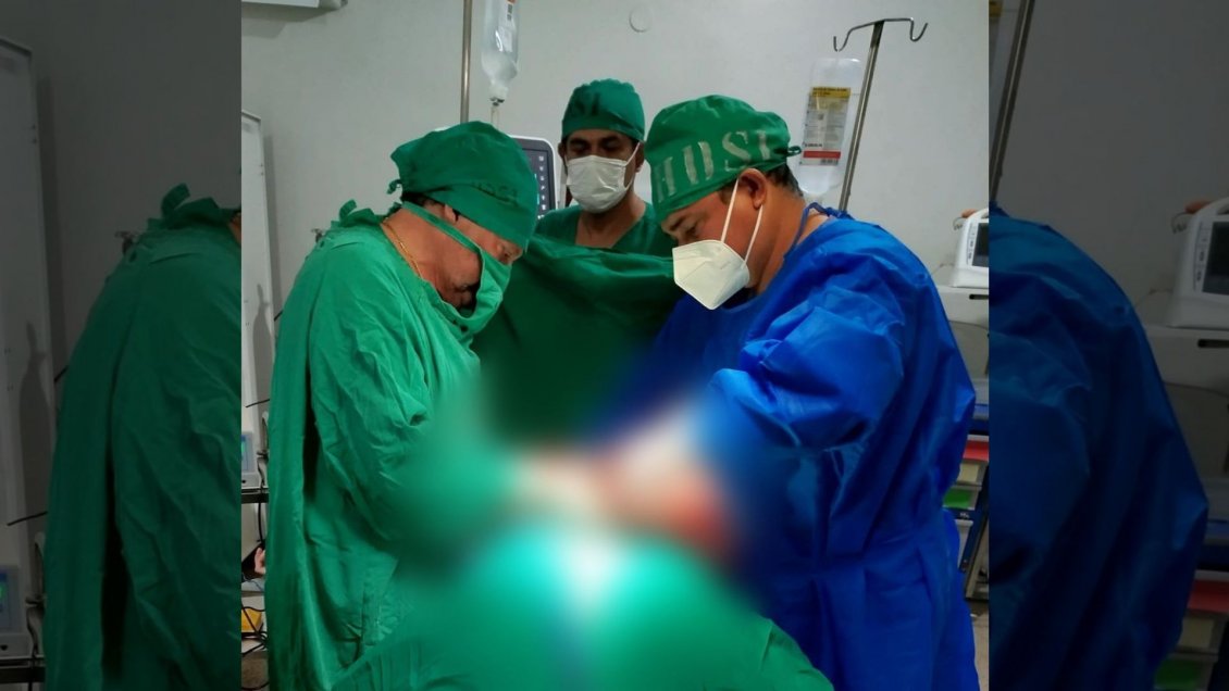 Extirparon un quiste ovárico de 12 kilos en Paraguay