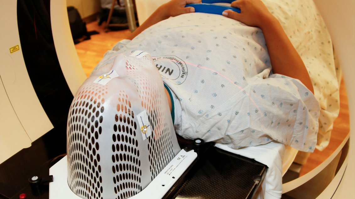 Científicos encontraron mecanismo para mejorar supervivencia a la radiación