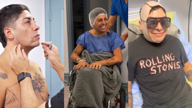 Botota Fox muestra drástica cirugía estética: 