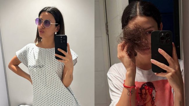 Karla Melo y su sentida reflexión sobre el tratamiento contra el cáncer: 