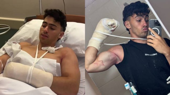 Influencer Gero Arias sufrió grave accidente durante actividad extrema: perdió dos dedos