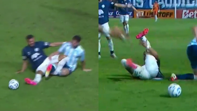 La escalofriante lesión que sufrió jugador de Independiente Rivadavia ante Racing