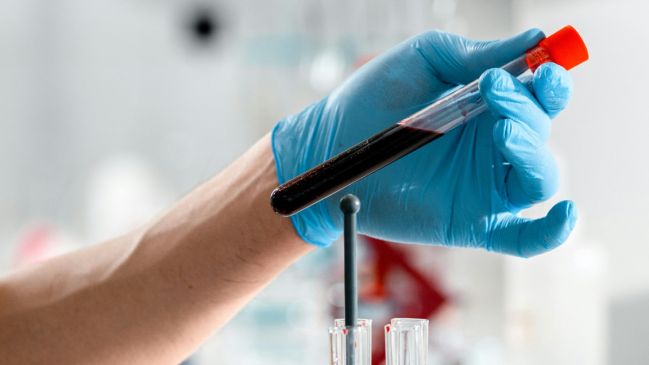 EE.UU. aprueba el primer test sanguíneo para ayudar a detectar el Alzhéimer