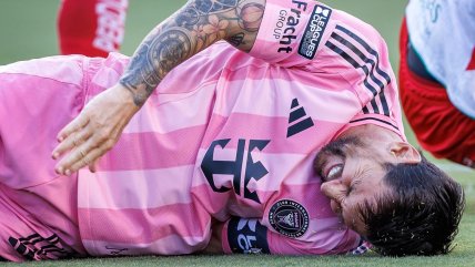   Lionel Messi sufrió 