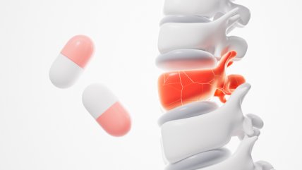   Espondilitis anquilosante: la enfermedad silenciosa que puede llevar a la invalidez 